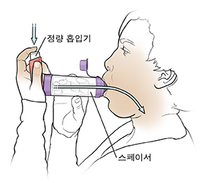 스페이서가 있는 정량 흡입기를 사용하는 여성.