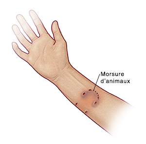 Morsure d'animaux