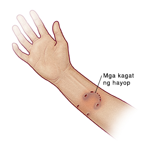 Mga kagat ng hayop