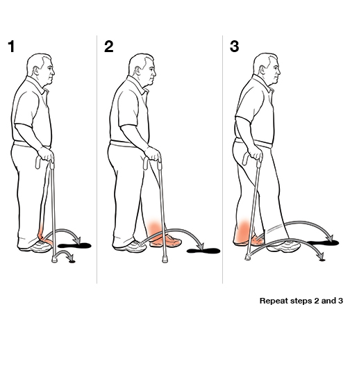 3 steps in using a cane.