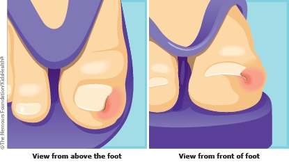 KidsHealth Image