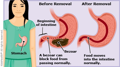 KidsHealth Image