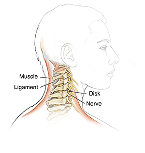 Side view of head and neck showing spine, ligaments, discs, nerves, and muscles.