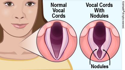 KidsHealth Image