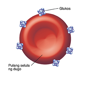 Pulang selula ng dugo na may nakadikit na mga molecule ng glucose.