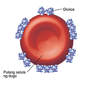 Pulang selula ng dugo na maraming nakadikit na mga molecule ng glucose.