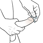 Hombre que se coloca un condón sobre la punta del pene erecto.