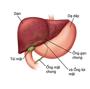 Đường nét của thân mình cho thấy gan và bao tử với phần cắt ngang của túi mật có sỏi trong đó.